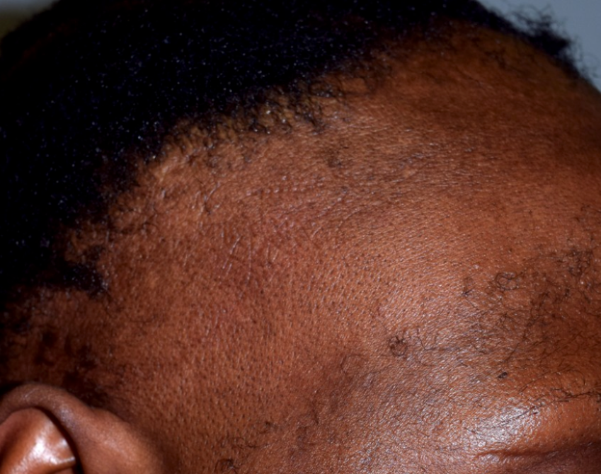 Alopecia (Hair Loss, Thinning & Shedding) – Every Strand Matters—Let’s Get to the Root Cause